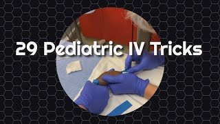 29 Pediatric IV Tricks [upl. by Eislek]