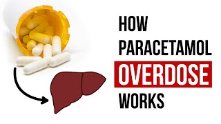 How Paracetamol Overdose Works [upl. by Sparke]