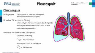 Chirurgie ─ Pleuraspalt Teil 12 [upl. by Orofselet]