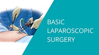 Basic Laparoscopic Surgery [upl. by Quick]