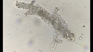 Amoeba movement with pseudopodia under a microscope [upl. by Charo]