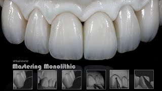 Mastering Monolithic Zirconia IN ENGLISH [upl. by Lak875]