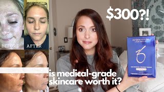 MY SKINCARE ROUTINE ZO SKIN HEALTH REVIEW AND 1 MONTH RESULTS  is medicalgrade worth the money [upl. by Malory670]