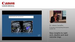 Dr Julene Carvalho  New Insights to Right Arch Double Arch and Vascular Rings [upl. by Kaia]