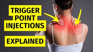 Myofascial Pain Trigger Point Injections Explained [upl. by Ahsyia]