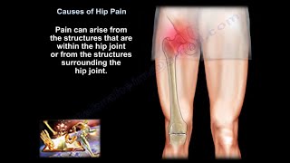 hip pain causes diagnosis and treatment [upl. by Sufur]