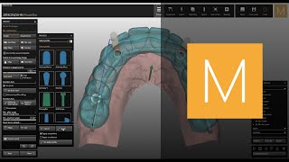 Bars module of ZirkonzahnModellier  ZirkonzahnSoftware [upl. by Itirahc670]