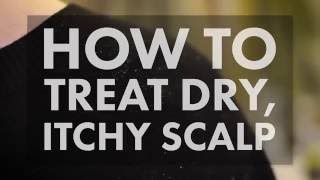 How to Treat a Dry Itchy Scalp  WebMD [upl. by Anitsihc]