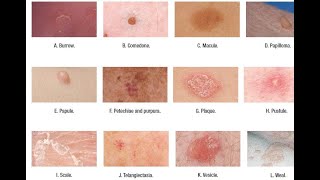 Skin Lesions with defination [upl. by Danette]