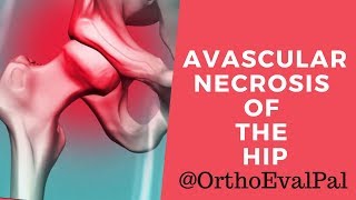 Avascular Necrosis of the HipExplained by Paul at Ortho Eval Pal [upl. by Weinstock241]