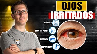 8 REMEDIOS NATURALES PARA LOS OJOS IRRITADOS [upl. by Yenaiv572]