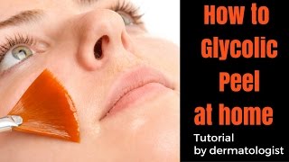 How to Glycolic Peel at HOME [upl. by Wasson709]