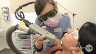 Laser Hair Removal  How does it work [upl. by Sabas]