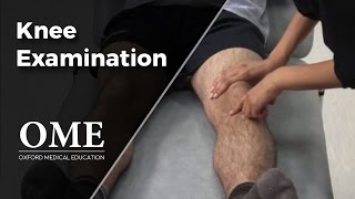 Knee Examination  Orthopaedics [upl. by Braynard752]