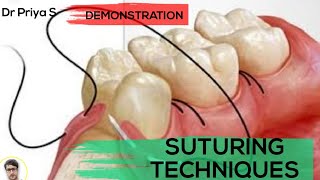 SUTURING TECHNIQUESDEMONSTRATION [upl. by Karylin]