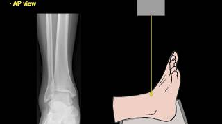 Anatomy of Ankle Xrays [upl. by Brenden]