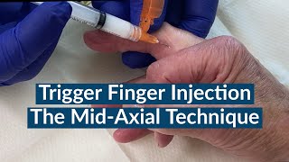 Trigger Finger Injection  The MidAxial Approach [upl. by Nerfe]