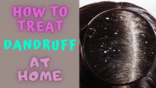 HOW TO TREAT DANDRUFF AT HOME  Dandruff Medical and Home Remedies [upl. by Nyliret]